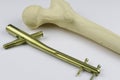 External fixation deviÃÂe in case of open fractures treatment